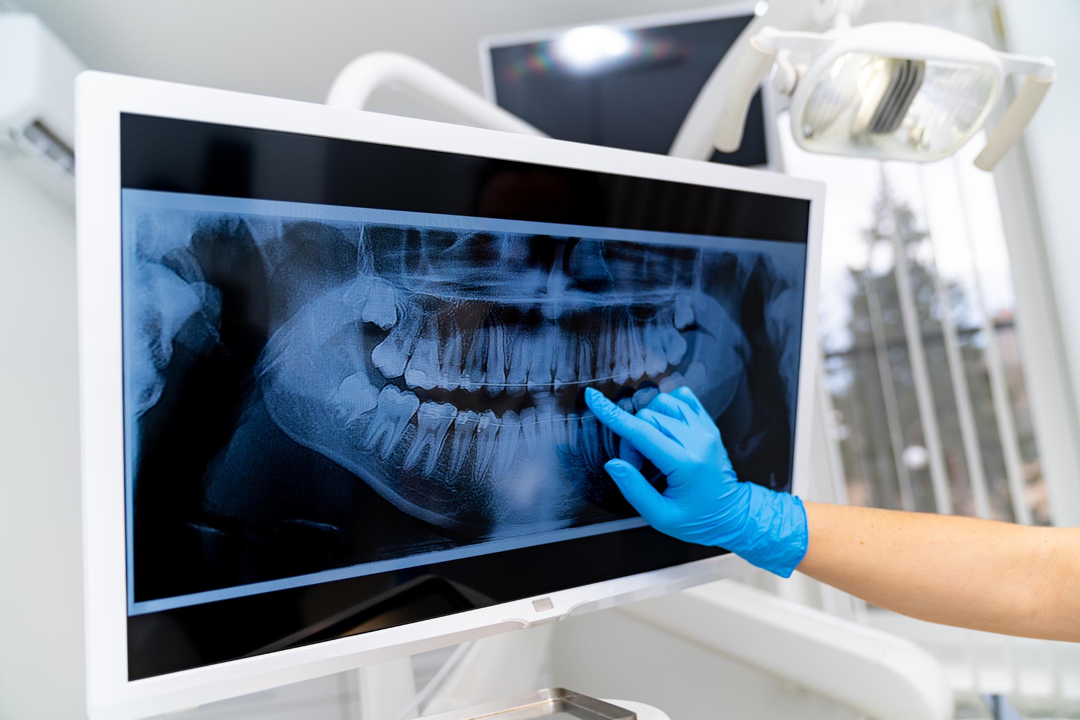 Digital imaging in the operatory